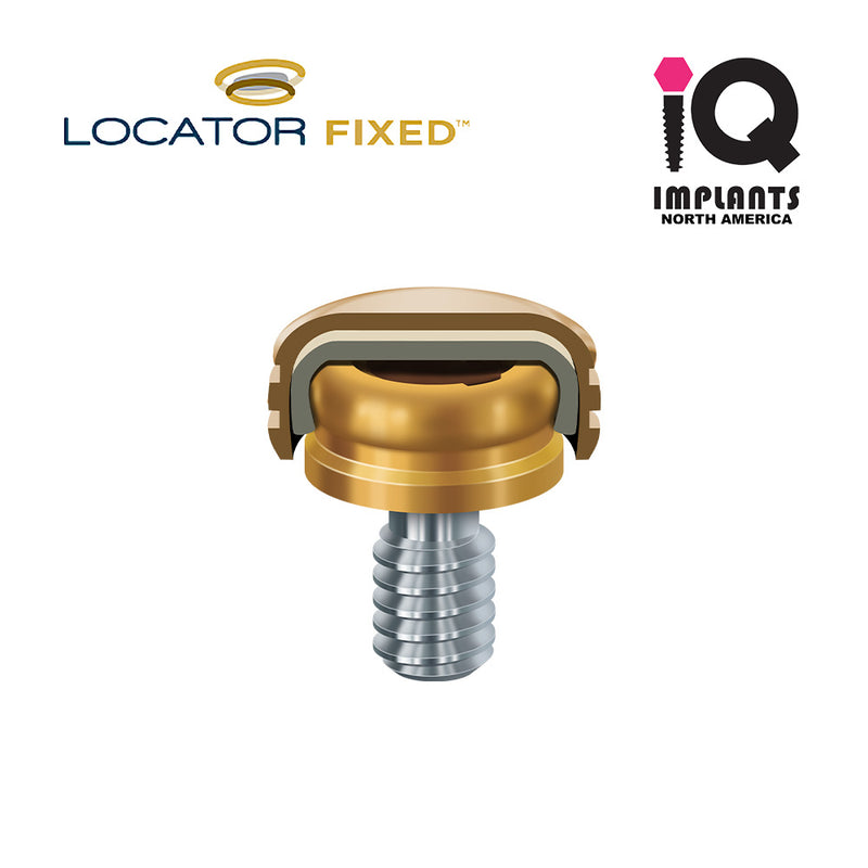 Locator System - IQ IMPLANTS USA
