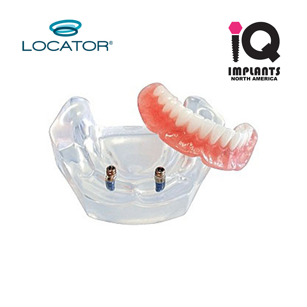 LOCATOR LEGACY (Classic) Essential Patient Education Model