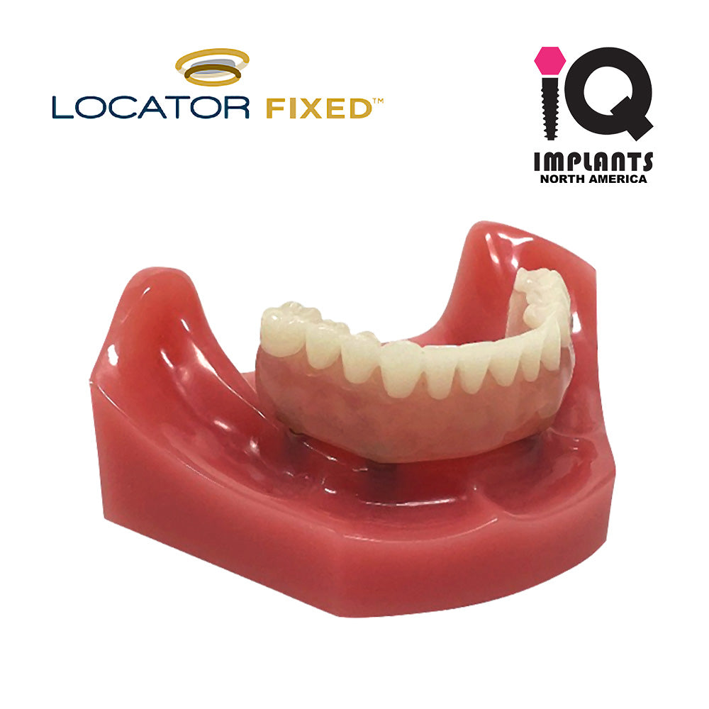 LOCATOR FIXED Essential Patient Education Model