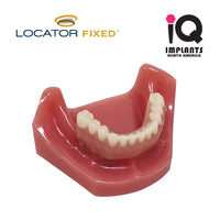 LOCATOR FIXED Essential Patient Education Model - IQ IMPLANTS USA