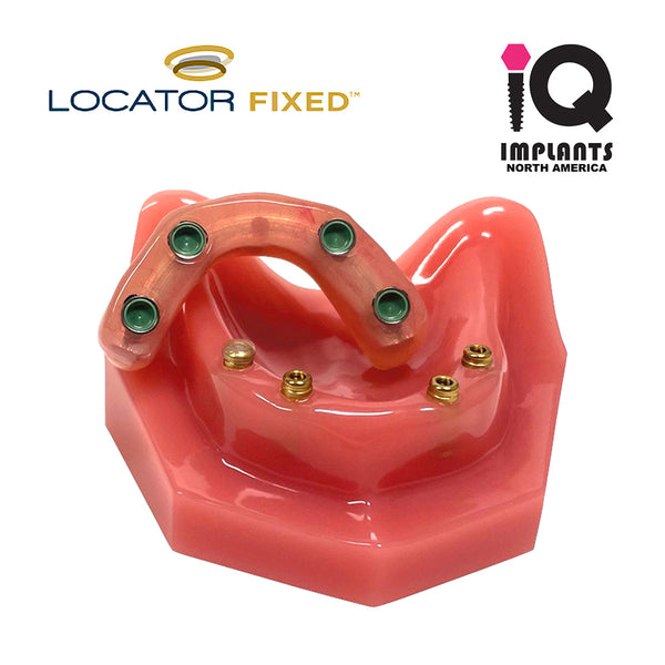 LOCATOR FIXED Essential Patient Education Model - IQ IMPLANTS USA