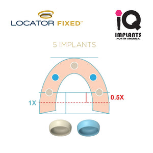 LOCATOR FIXED Processing Package, Anterior/Posterior, Tan (1-Pack)