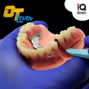 OT Lever - Universal Removal tool for dental prosthesis or aligners