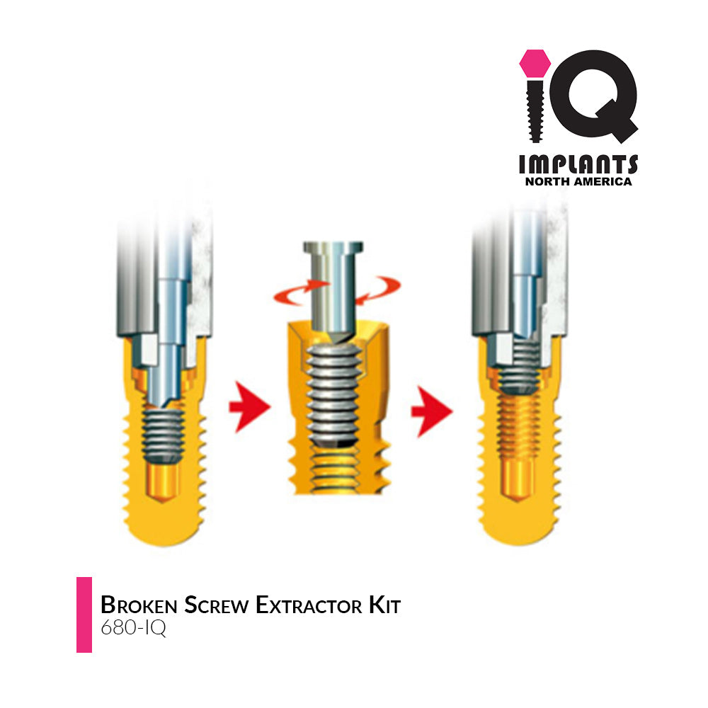 Broken Screw Extractor Kit for IQ Implants and Compatibles